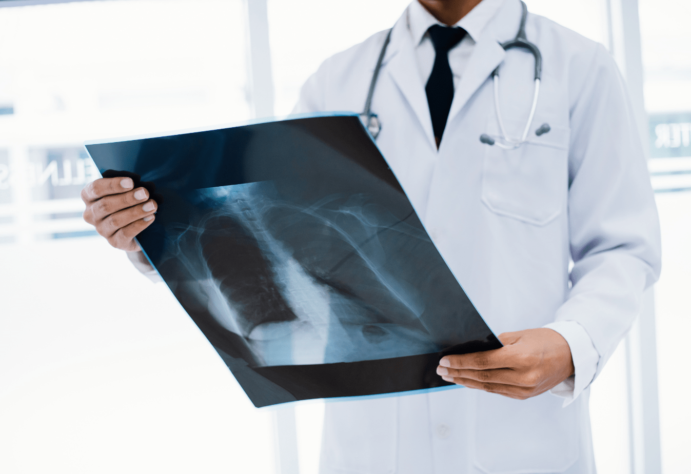 doctor holding an xray of a chest