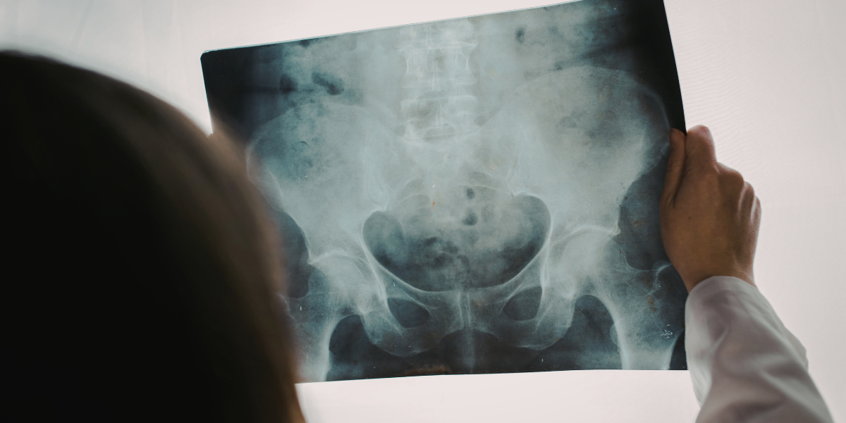 doctor examining a pelvic x-ray