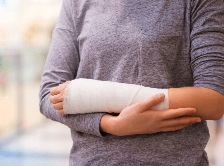 a person with a broken arm